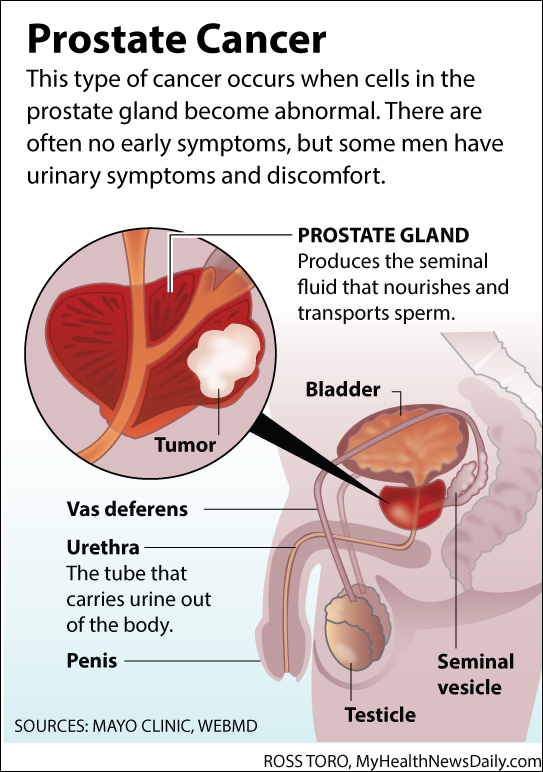 What does prostate cancer do to you